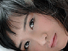 子宮肌瘤鑒別診斷之二